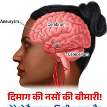 मस्तिष्क और तंत्रिका रोग (Neurology)